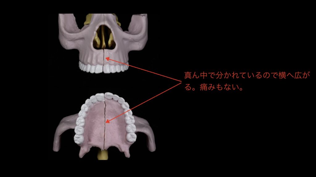 小児矯正顎のサイズ図