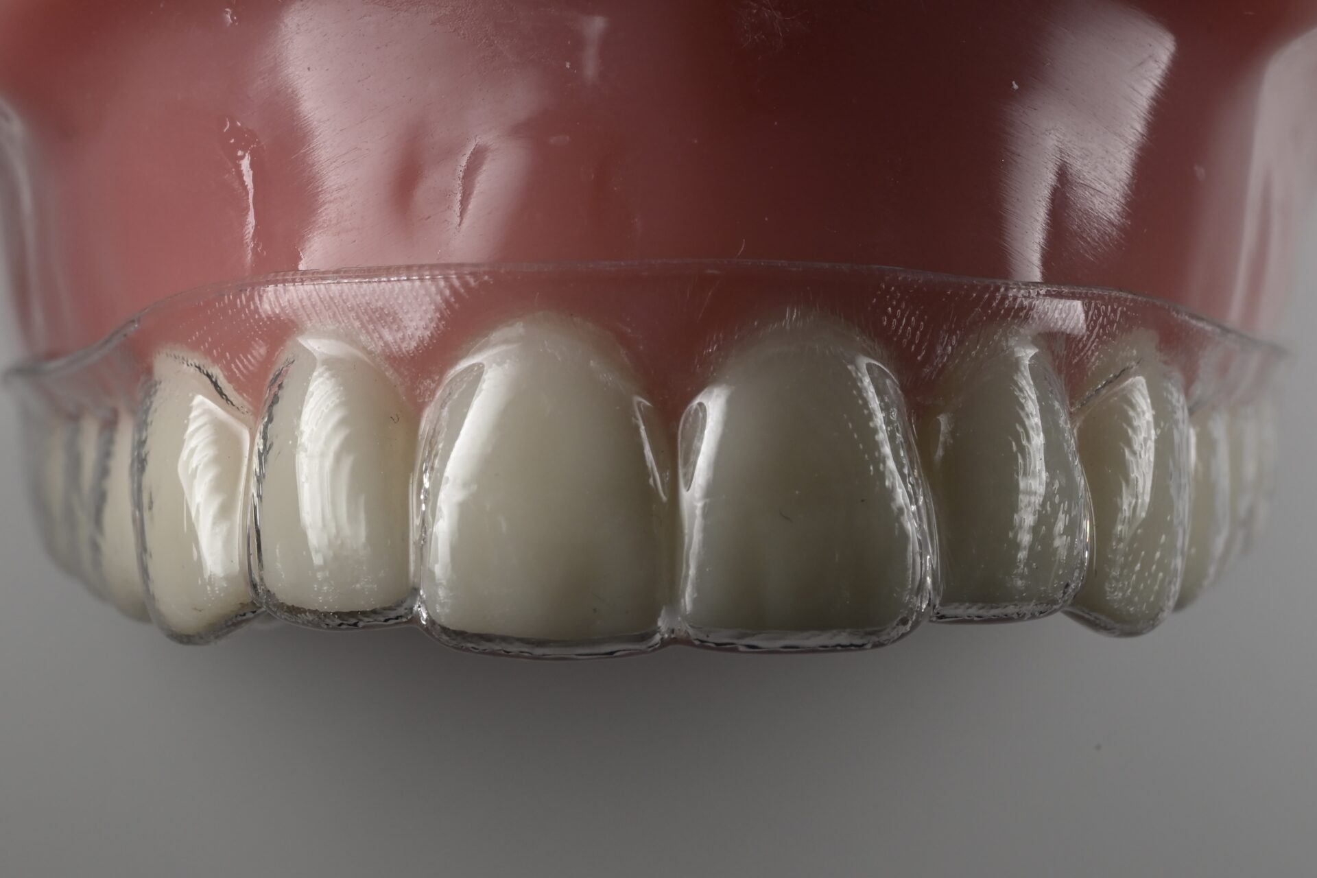 マウスピースを付けた歯の模型写真