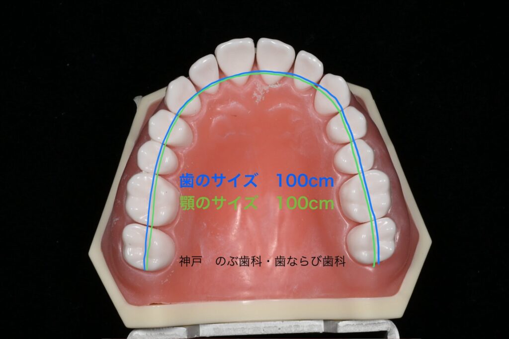 歯科矯正歯の正しいサイズ図