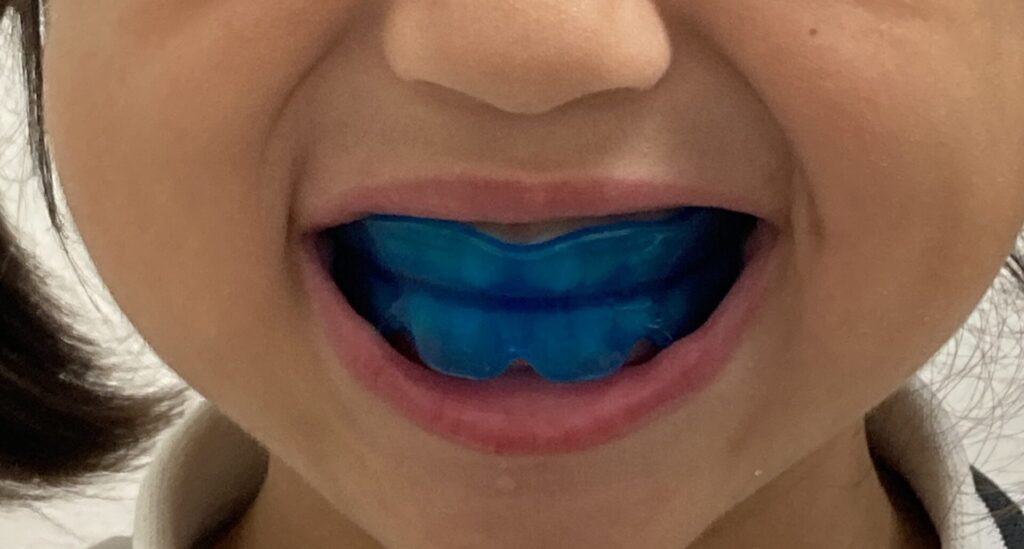 プレオルソを装着