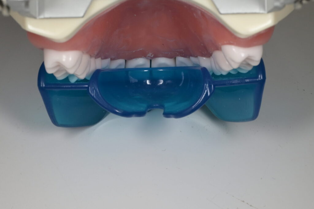 プレオルソの模型を横から見た図