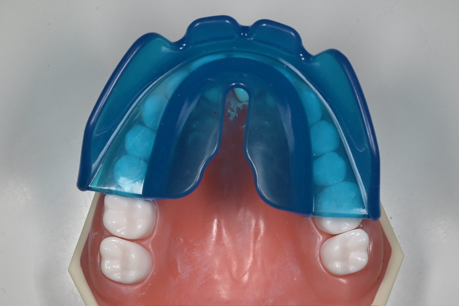 プレオルソの見本模型