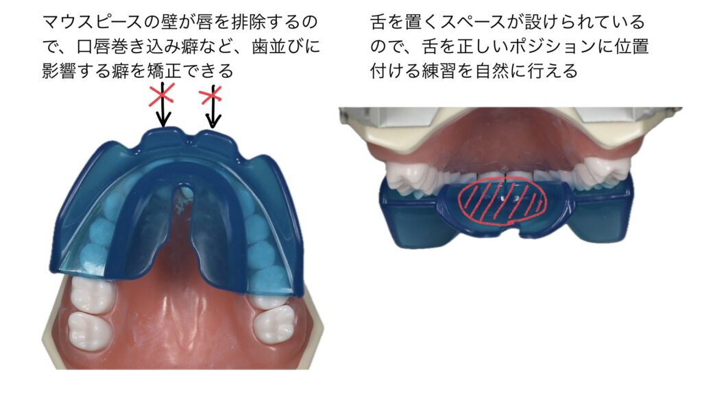 プレオルソの説明
