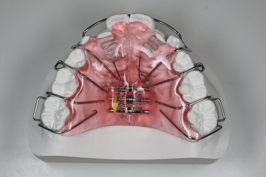 床矯正装置の模型