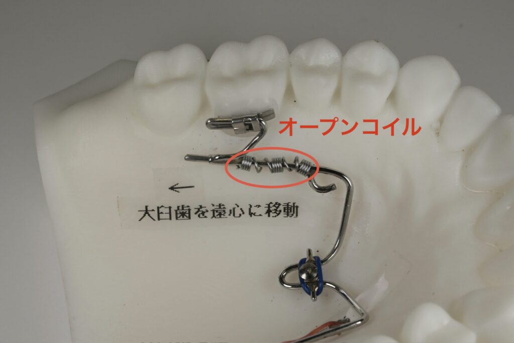 歯体移動の器具説明